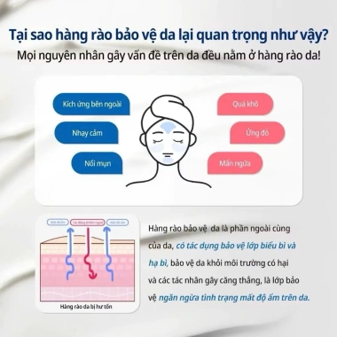 Kem dưỡng B5 Some By Mi 50g - D-Parthenol 5% + Peptides, phục hồi da chuyên sâu, giảm giá 299.000 VNĐ