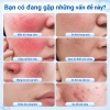 Kem dưỡng B5 YOUNAISI Bisabolol 40ml - Dưỡng ẩm, làm dịu da khô, nhạy cảm, nhờn - Giá ưu đãi 158.000đ 2