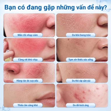 Kem dưỡng B5 YOUNAISI Bisabolol 40ml - Dưỡng ẩm, làm dịu da khô, nhạy cảm, nhờn - Giá ưu đãi 158.000đ
