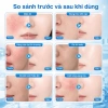 Kem dưỡng B5 YOUNAISI Bisabolol 40ml - Dưỡng ẩm, làm dịu da khô, nhạy cảm, nhờn - Giá ưu đãi 158.000đ 3