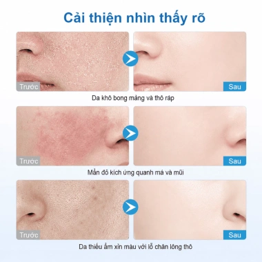 Kem dưỡng B5 YOUNAISI Bisabolol 40ml - Dưỡng ẩm, làm dịu da khô, nhạy cảm, nhờn - Giá ưu đãi 158.000đ
