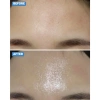 Kem Dưỡng Cemenzal Conapidil Light 100ml - Tái định vị da, phục hồi, chống lão hóa, cải thiện sẹo mụn - 3,549,000₫ 4