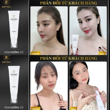 Kem Dưỡng Cổ Neck Cream Baby Milk 50g - Hàng Hiệu Cao Thiên Nhi, Giá gốc 2.160.000, giảm còn 1.800.000