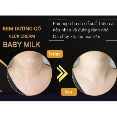 Kem Dưỡng Cổ Neck Cream Baby Milk 7g Hàng Hiệu Cao Thiên Nhi Dưỡng ẩm sâu giảm nếp nhăn giá ưu đãi 295.000 VND