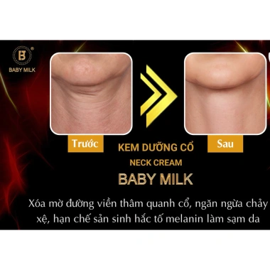Kem Dưỡng Cổ Neck Cream Baby Milk 7g Hàng Hiệu Cao Thiên Nhi Dưỡng ẩm sâu giảm nếp nhăn giá ưu đãi 295.000 VND 4 Kem Dưỡng Cổ Neck Cream Baby Milk 7g Hàng Hiệu Cao Thiên Nhi Dưỡng ẩm sâu giảm nếp nhăn giá ưu đãi 295.000 VND 4