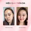 Kem Dưỡng Da Am to Pm 5% Melatonin Liposome 50ml – Chống lão hoá, Trắng da, Dưỡng ẩm sâu, Phục hồi – Giá 459k (giảm 23%) 7