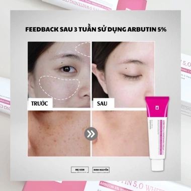 Kem Dưỡng Da Arbutin 5% Tosowoong Hàn Quốc 50ml: Trắng Sáng Mờ Nám Tàn Nhang Giảm Giá 343k