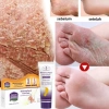Kem Dưỡng Da Chân 100ml Giảm Nứt, Làm Trắng, Bảo Vệ Gót Chân Hiệu Quả