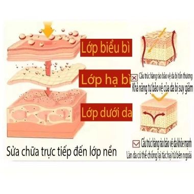 Kem dưỡng da giảm ngứa cho da dị ứng, viêm da do ánh sáng, ngứa đầu và tay chân - Giá chỉ 59.000₫ (giá gốc 74.340₫) 6