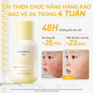 Kem dưỡng da mặt cho bé 0 tuổi 50g - Dưỡng ẩm sâu, làm dịu da nhạy cảm, không gây kích ứng 7
