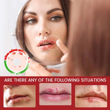Kem Dưỡng Da Môi Sumifun Chính Hãng - Giảm Viêm Đau, Dưỡng Ẩm, Sửa Môi Khô Nứt Nẻ, Làm Dịu Da - 42k 4