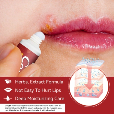 Kem Dưỡng Da Môi Sumifun Chính Hãng - Giảm Viêm Đau, Dưỡng Ẩm, Sửa Môi Khô Nứt Nẻ, Làm Dịu Da - 42k 6