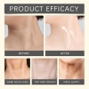 Kem dưỡng da vùng cổ MEDIPEEL sợi Naite cao cấp 100ml chống lão hóa Giá chỉ 379.000₫ 2