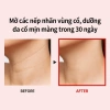 Kem dưỡng da vùng cổ MEDIPEEL sợi Naite cao cấp 100ml chống lão hóa Giá chỉ 379.000₫ 4