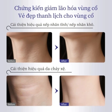 Kem dưỡng da vùng cổ MEDIPEEL sợi Naite cao cấp 100ml chống lão hóa Giá chỉ 379.000₫