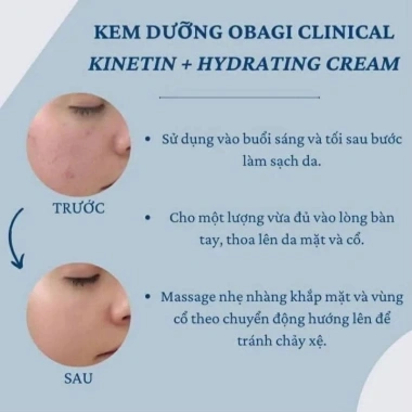 Kem dưỡng phục hồi Obagi KINETI N+ 50ml - Dưỡng ẩm, làm dịu da, giảm giá 450k đặc biệt 5 Kem dưỡng phục hồi Obagi KINETI N+ 50ml - Dưỡng ẩm, làm dịu da, giảm giá 450k đặc biệt 5