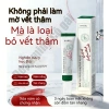 Kem dưỡng serum trắng da mặt Loại bỏ tàn nhang, tẩy mụn, giảm vết thâm - 49.999đ