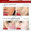 Kem dưỡng serum trắng da mặt Loại bỏ tàn nhang, tẩy mụn, giảm vết thâm - 49.999đ 2