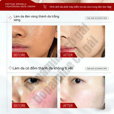 Kem dưỡng serum trắng da mặt Loại bỏ tàn nhang, tẩy mụn, giảm vết thâm - 49.999đ