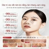 Kem dưỡng serum trắng da mặt Loại bỏ tàn nhang, tẩy mụn, giảm vết thâm - 49.999đ 3