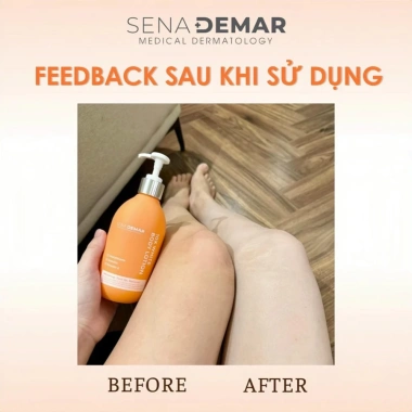 Kem Dưỡng Thể Senademar 10X White Body Lotion 300ml - Dưỡng trắng, cấp ẩm, phục hồi da săn chắc, giá 460.000 VND 8 Kem Dưỡng Thể Senademar 10X White Body Lotion 300ml - Dưỡng trắng, cấp ẩm, phục hồi da săn chắc, giá 460.000 VND 8