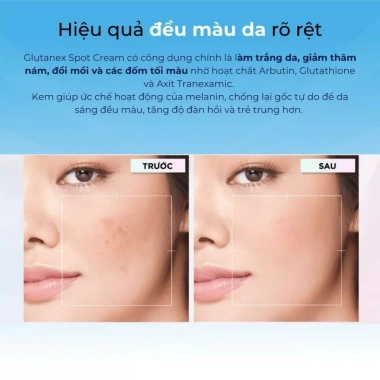 Kem dưỡng trắng da GLUTANEX Spot Cream Arbutin Tranexamic Glutathione mờ thâm nám 1.02tr 2