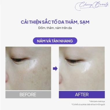 Kem Dưỡng Trắng Da Mờ Nám Tàn Nhang Chống Lão Hóa Maxclinic Time Return Melatonin 50g - Giá chỉ 560.000đ