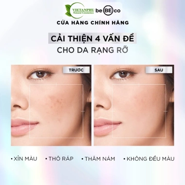 Kem dưỡng trắng da YAKA Moisturizing - Cấp ẩm, phục hồi da tổn thương, xóa nếp nhăn, đồng đều màu, chỉ 465.800₫ 3