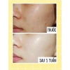 Kem Dưỡng Trắng HEMION - Dưỡng ẩm sâu, Da sáng mịn, tặng Mặt Nạ, giảm giá 330k 6