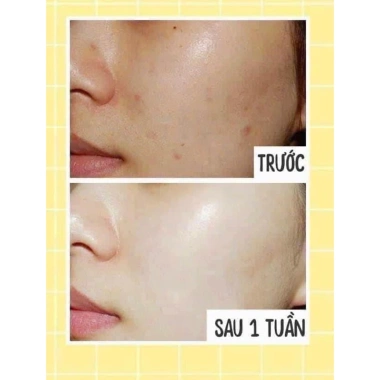 Kem Dưỡng Trắng HEMION - Dưỡng ẩm sâu, Da sáng mịn, tặng Mặt Nạ, giảm giá 330k 6