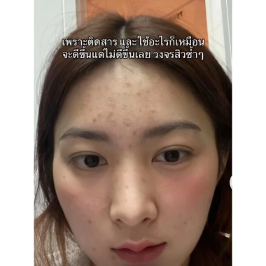 Kem Face Sâm Darin Ginseng Cream – Làm trắng da, mờ thâm mụn, chỉ 649.000 VNĐ 8