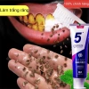 Kem Fresh Breath làm trắng, loại bỏ răng ố vàng, cao răng, trẻ em - 35.000₫ 2