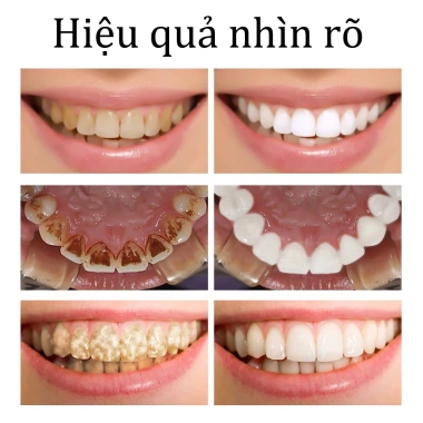 Kem Fresh Breath làm trắng, loại bỏ răng ố vàng, cao răng, trẻ em - 35.000₫ 4
