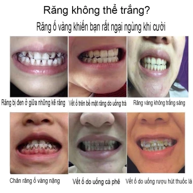 Kem Fresh Breath làm trắng, loại bỏ răng ố vàng, cao răng, trẻ em - 35.000₫ 6