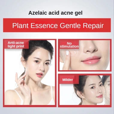 Kem giảm mụn 15% Axit Salicylic 15g - Giảm sẹo nhanh, hiệu quả, giá chỉ 61.600 VND