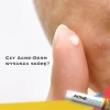 Kem giảm mụn Acne Derm 20% Azelaic Acid 20g - Mờ thâm, trắng sáng da, 160.000đ 5