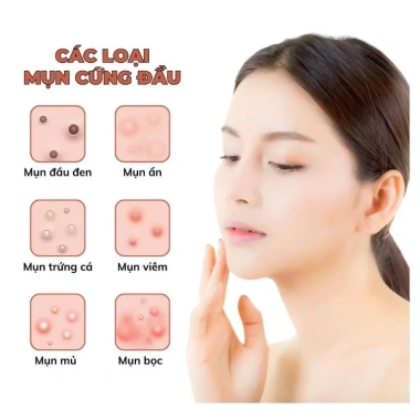 Kem giảm mụn siêu tốc Mềm Beauty One Day 50g - Mờ thâm, trắng da, giá 290k (giá gốc 374k)