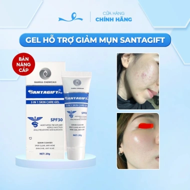 Kem Giảm Thâm Mụn An Toàn SANTAGIFT SPF30 20g Ức Chế Sắc Tố Chống Nắng Giá 149k