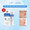 Kem Giảm Thâm Mụn An Toàn SANTAGIFT SPF30 20g Ức Chế Sắc Tố Chống Nắng Giá 149k 3