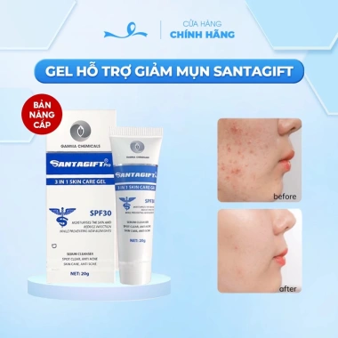Kem Giảm Thâm Mụn An Toàn SANTAGIFT SPF30 20g Ức Chế Sắc Tố Chống Nắng Giá 149k