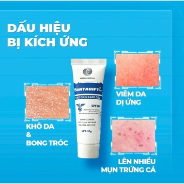 Kem Giảm Thâm Mụn An Toàn SANTAGIFT SPF30 20g Ức Chế Sắc Tố Chống Nắng Giá 149k