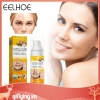 Kem hỗ trợ giảm mụn Cystic 30ml dưỡng ẩm, làm trắng da, giảm sưng, giảm giá 20% chỉ 79.970đ