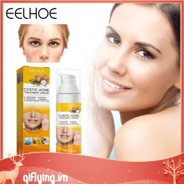 Kem hỗ trợ giảm mụn Cystic 30ml dưỡng ẩm, làm trắng da, giảm sưng, giảm giá 20% chỉ 79.970đ