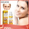 Kem hỗ trợ giảm mụn Cystic 30ml dưỡng ẩm, làm trắng da, giảm sưng, giảm giá 20% chỉ 79.970đ 2