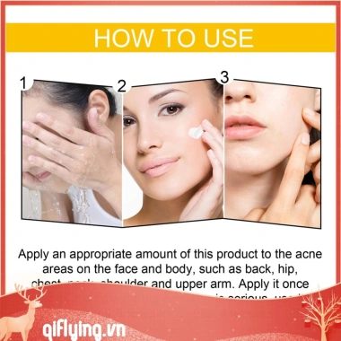 Kem hỗ trợ giảm mụn Cystic 30ml dưỡng ẩm, làm trắng da, giảm sưng, giảm giá 20% chỉ 79.970đ