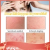 Kem hỗ trợ giảm mụn Cystic 30ml dưỡng ẩm, làm trắng da, giảm sưng, giảm giá 20% chỉ 79.970đ 6