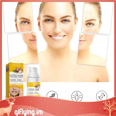 Kem hỗ trợ giảm mụn Cystic 30ml dưỡng ẩm, làm trắng da, giảm sưng, giảm giá 20% chỉ 79.970đ