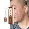 Kem làm mịn da ZHENXIU – Sáng da, giảm nếp nhăn melanin, hỗ trợ giảm mụn, vết sẹo – 45.881đ