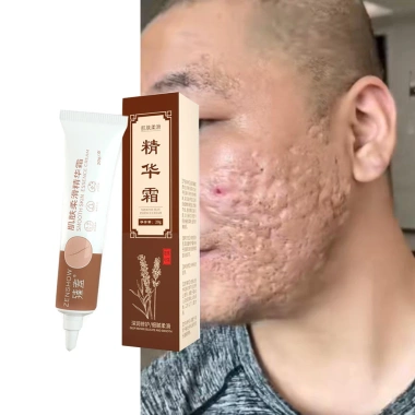 Kem làm mịn da ZHENXIU – Sáng da, giảm nếp nhăn melanin, hỗ trợ giảm mụn, vết sẹo – 45.881đ