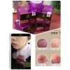 Kem Mụn 2C - Xóa mụn, nám, tàn nhang nhanh, giảm thâm, giá ưu đãi 77.000đ 4